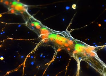 Post-Spinal Cord Injury: Neurons Post-Spinal Cord Injury: Microglia Found to Protect Synapses